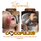 Cocopulko Moisturizing Cream 100ml — Deep Hydration with Coconut Oil & Akapulko Extract | UAE