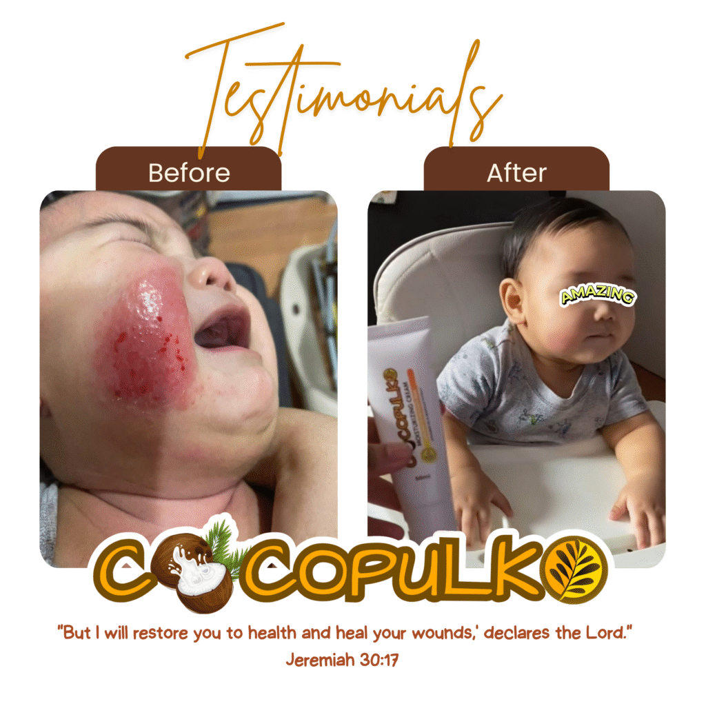 Cocopulko Moisturizing Cream 100ml — Deep Hydration with Coconut Oil & Akapulko Extract | UAE