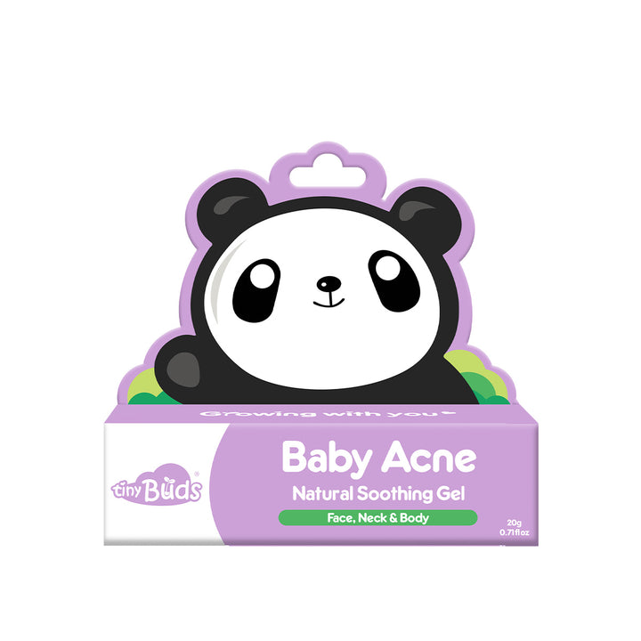 Tiny Buds Baby Acne Soothing gel (20g) - Extra Value Mart