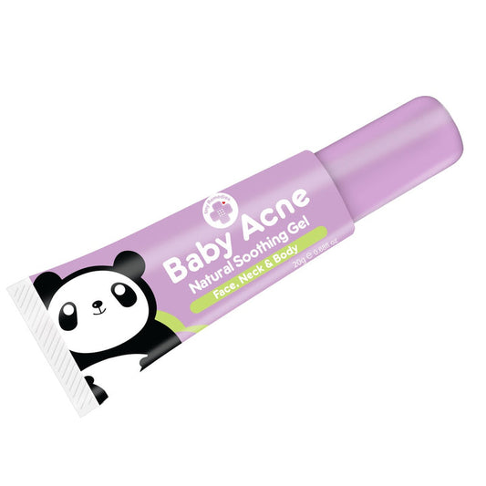 Tiny Buds Baby Acne Soothing gel (20g) - Extra Value Mart